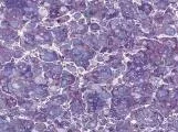 S S Amethysl main texture preview