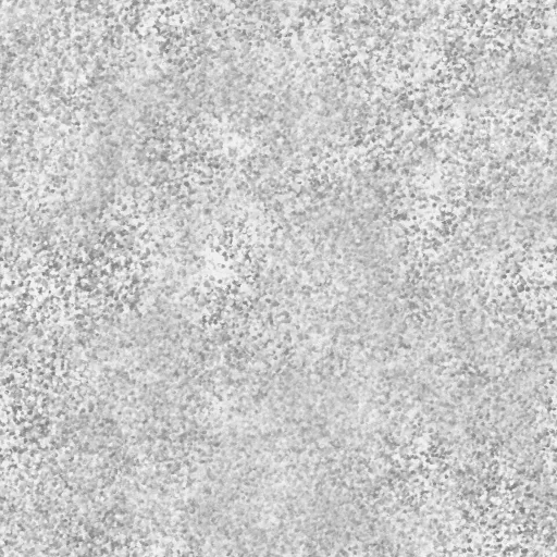 Torley Com Seuratski Png By The One And Only Torley (Cc By) main texture preview